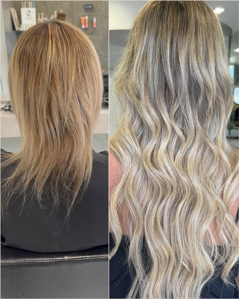 Antes e depois em caso de alopecia